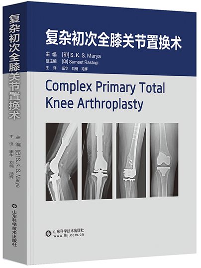複雜初次全膝關節置換術